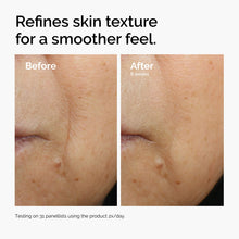 Before and after comparison of skin texture. After 8 weeks of twice-daily use of Caffeine 3% + Escin 1% Face Serum, the skin surface appears visibly smoother and more refined.